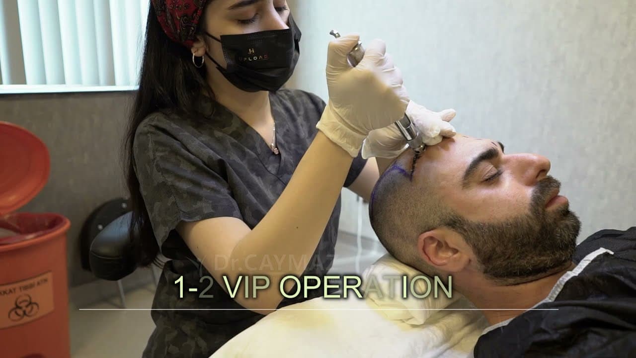 Dr Erkam Caymaz Hair Transplant all of Process in Istanbul