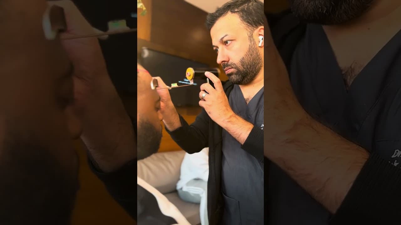 Best Hairline Creating