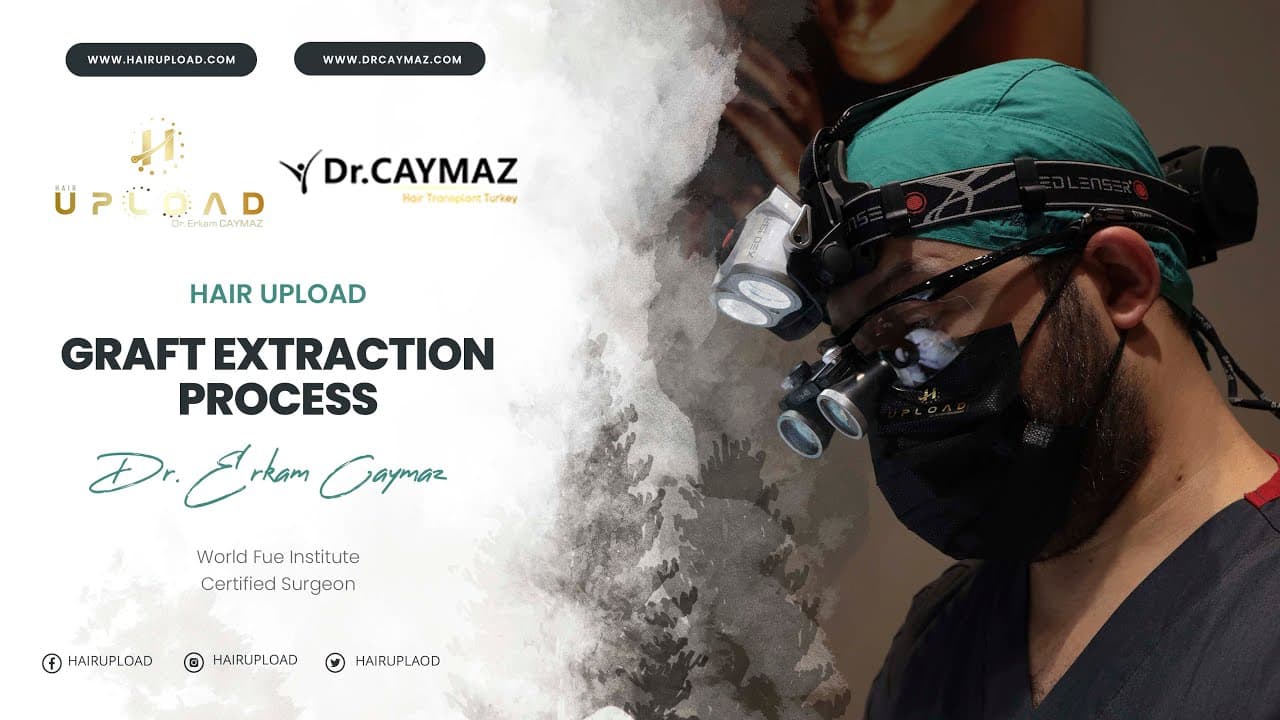 Graft Extraction Process - Hair Transplant Turkey