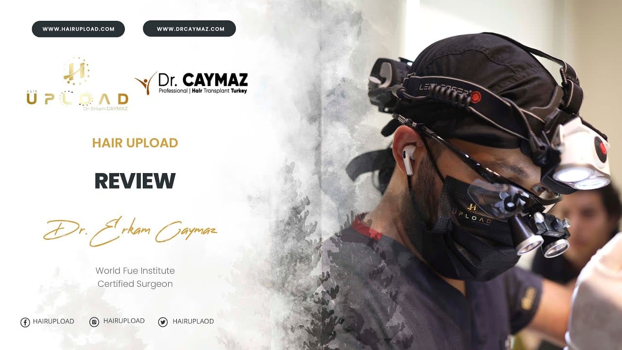 Sene Elhadjıb | Sapphire FUE | 2800 Graft | USA - Hair Transplant