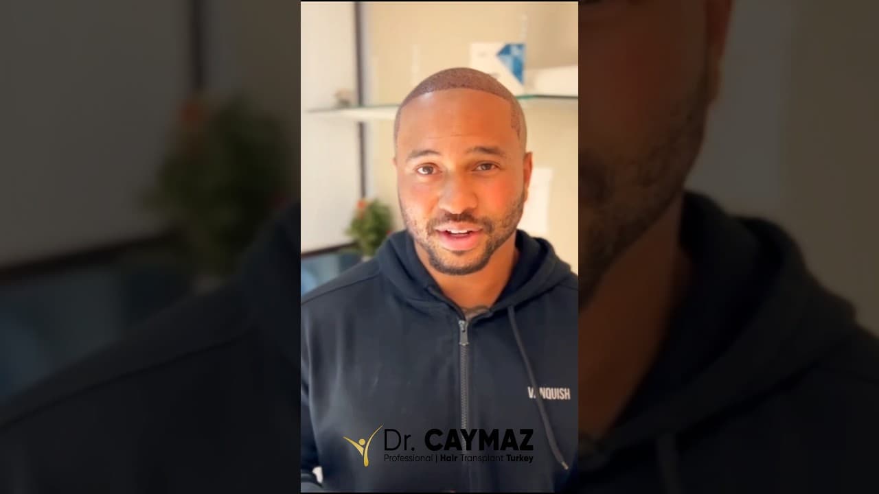 Hair Transplant in Istanbul Review