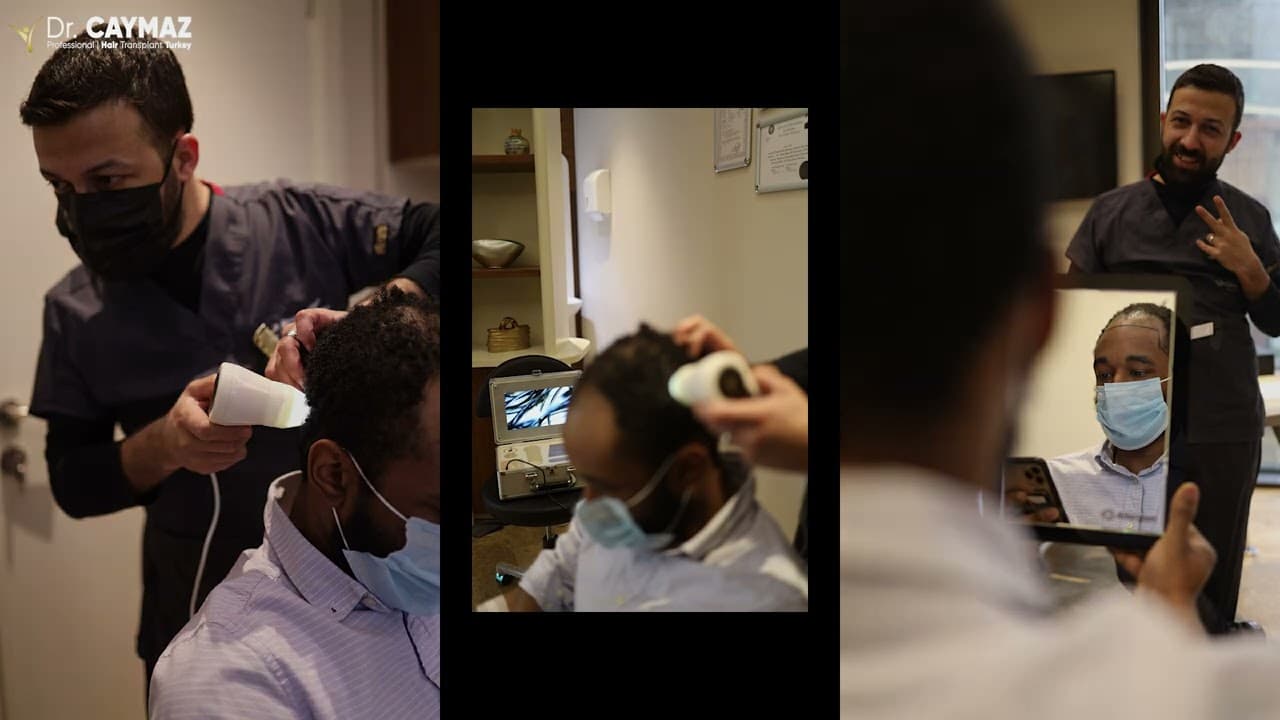 Mr. John | Sapphire FUE | 3900 Graft | USA - Hair Transplant Experience