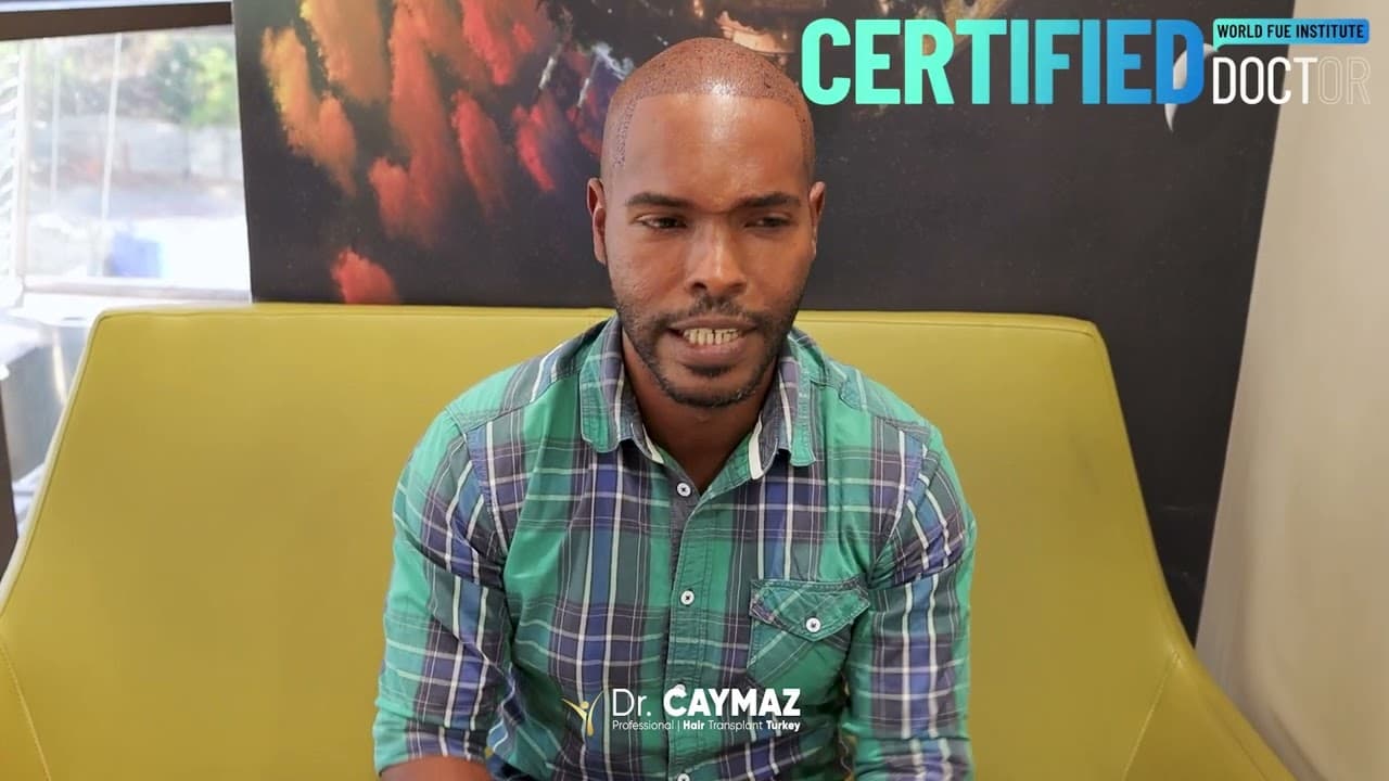 Martinez Herrera - Spain- 3500 Graft - Afro American Hair Transplant Review - Sapphire FUE