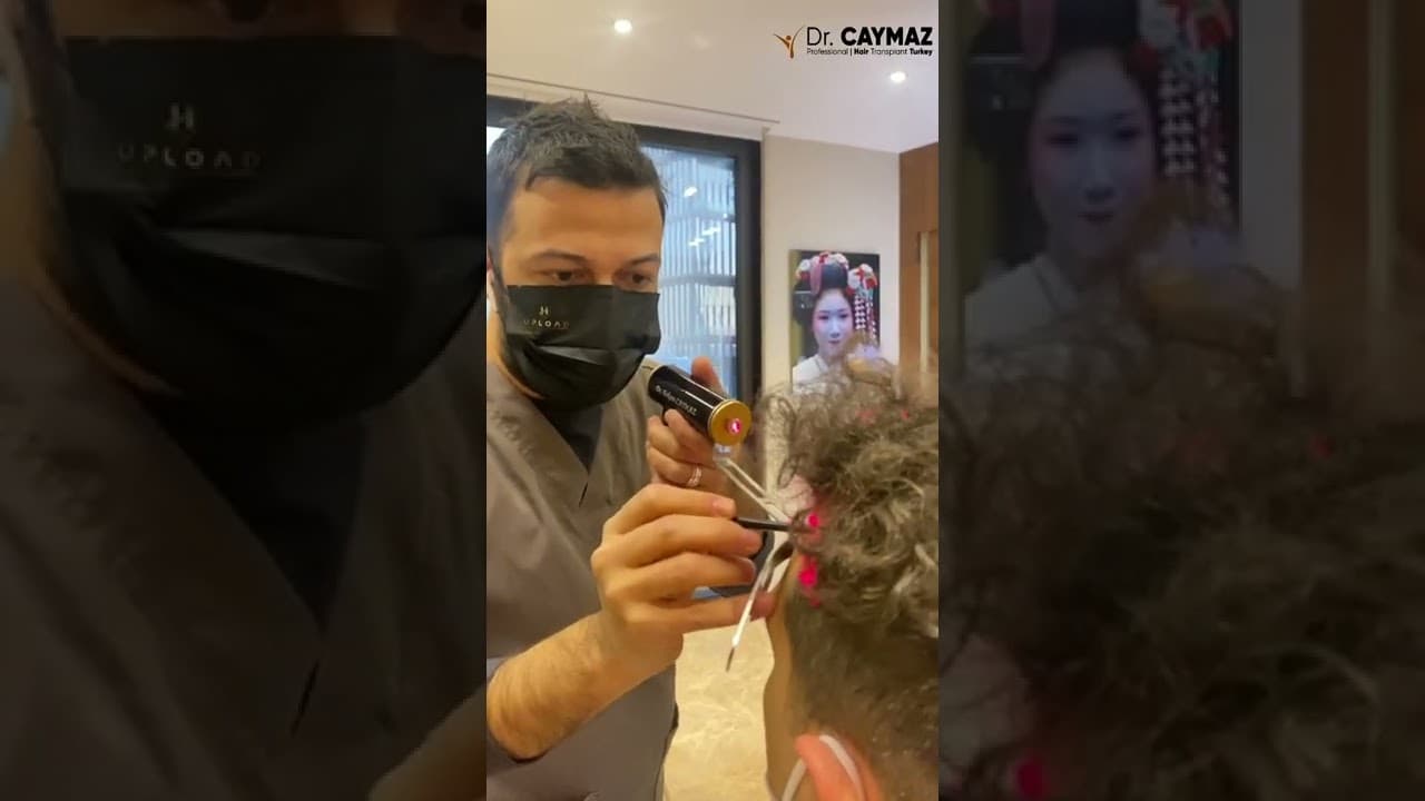 Hair Transplantation: One Day in Istanbul