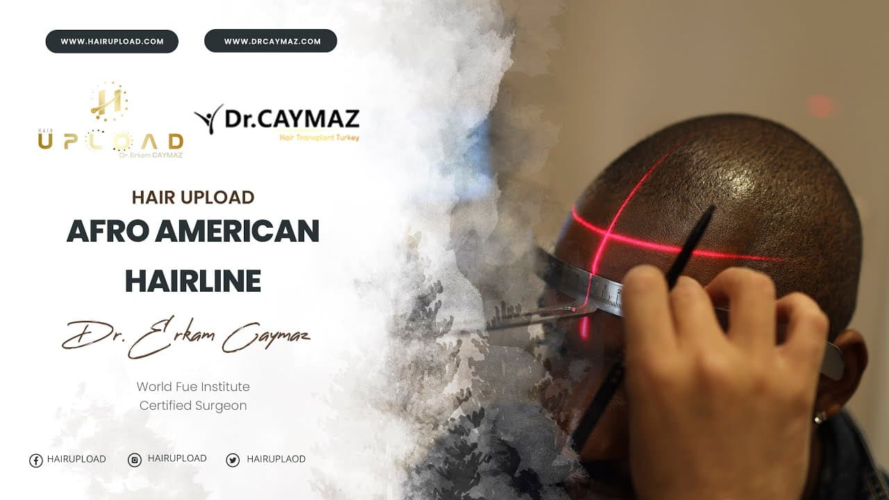 Afro-American Hairline Designing