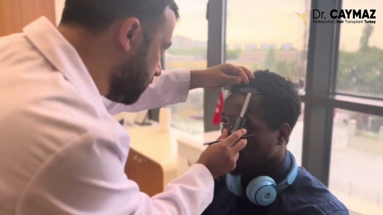 Vip Afro American Hair Transplantation