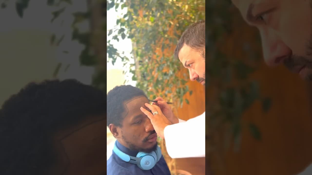 1-2 Vip Afro American Hair Transplantation