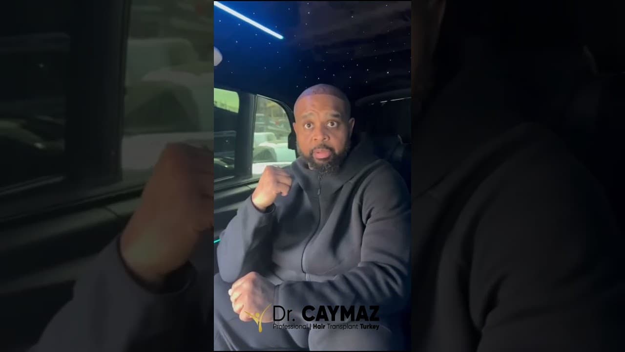 Hair Transplantation from Usa - Second Session