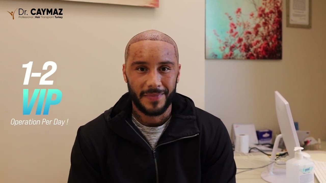 BRANDYN LEMAR - USA - 4400 Graft - Afro American Hair Transplant Review - Sapphire FUE