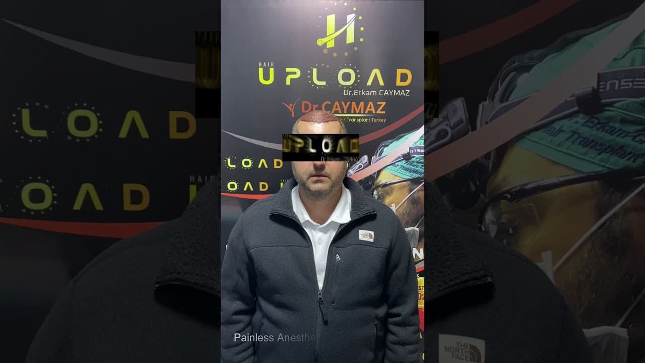 Mr Private from USA - 5000 Graft - Hair Upload Clinic - Hair Transplant in Istanbul Review