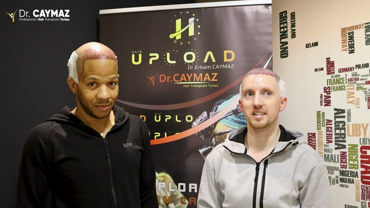 Wilbert LEE WEBB (2500 Graft) and Kurt Daniel LEE (4000 Graft) | Sapphire FUE | USA-Hair Transplant