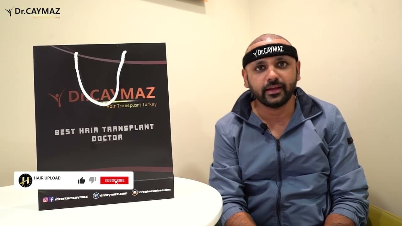 Hair Transplant from MR Shatir 2
