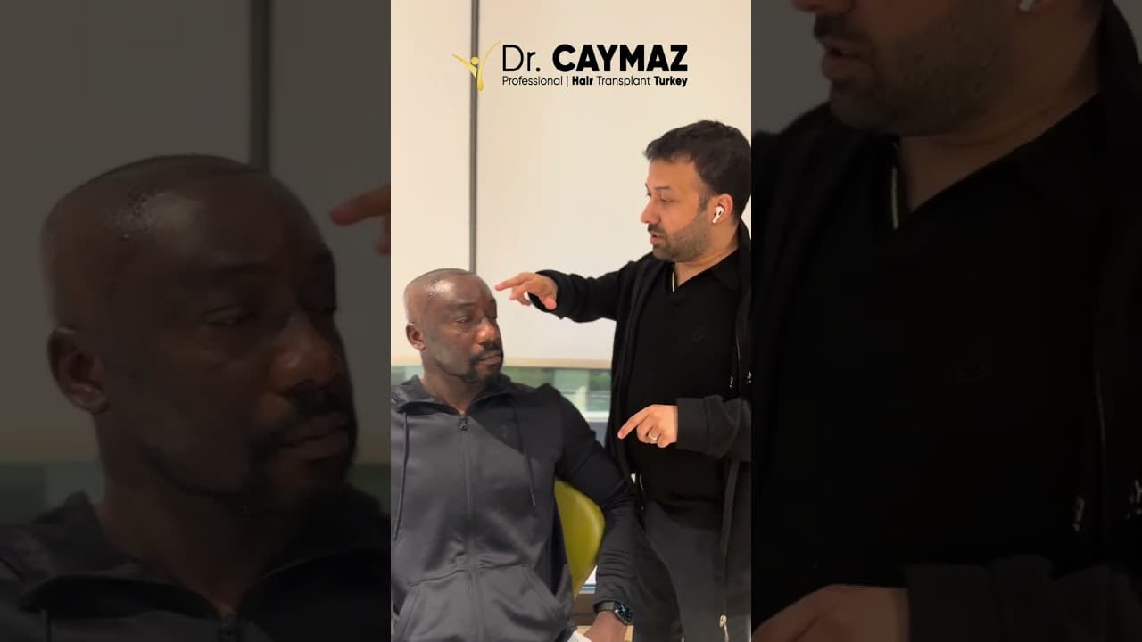 Afro Hair Transplant Review