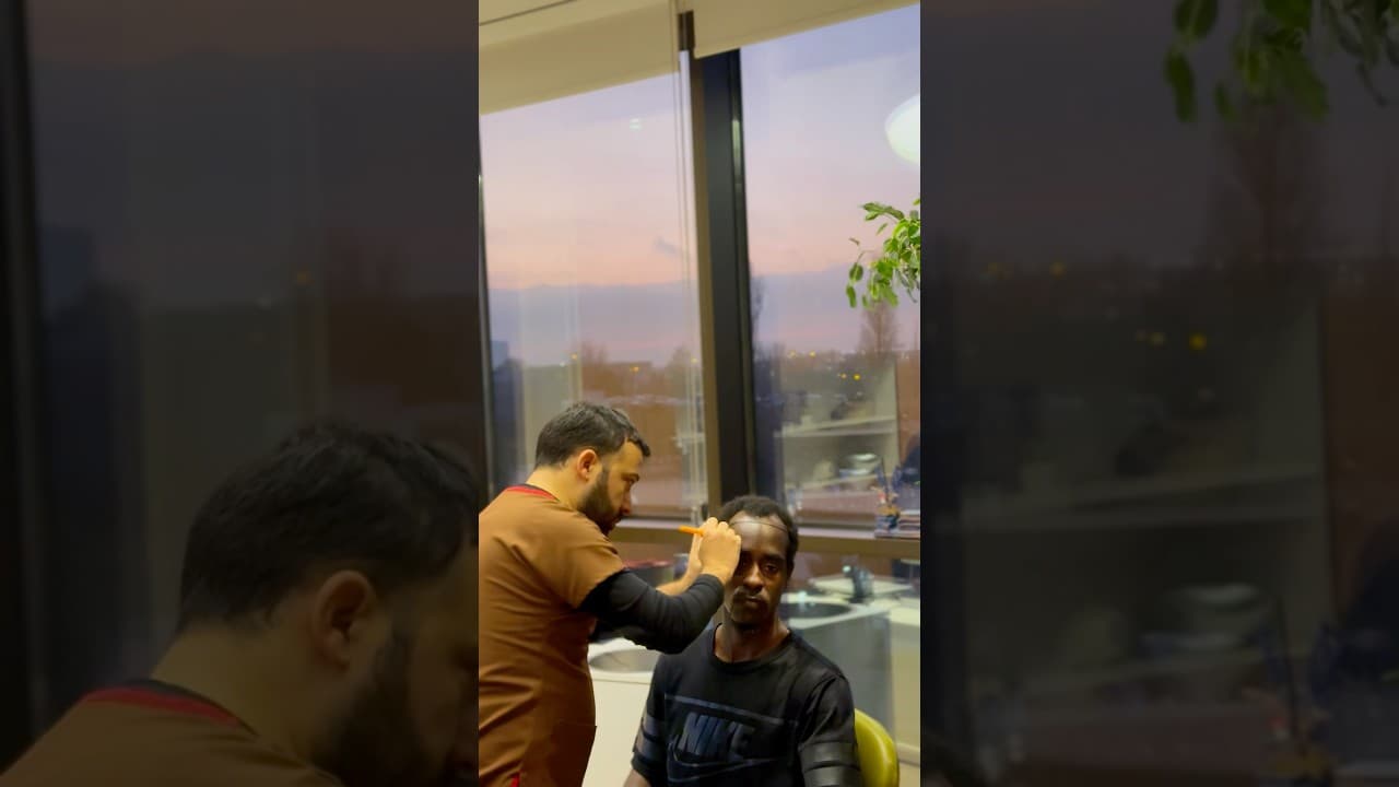 Check the Best Hairline