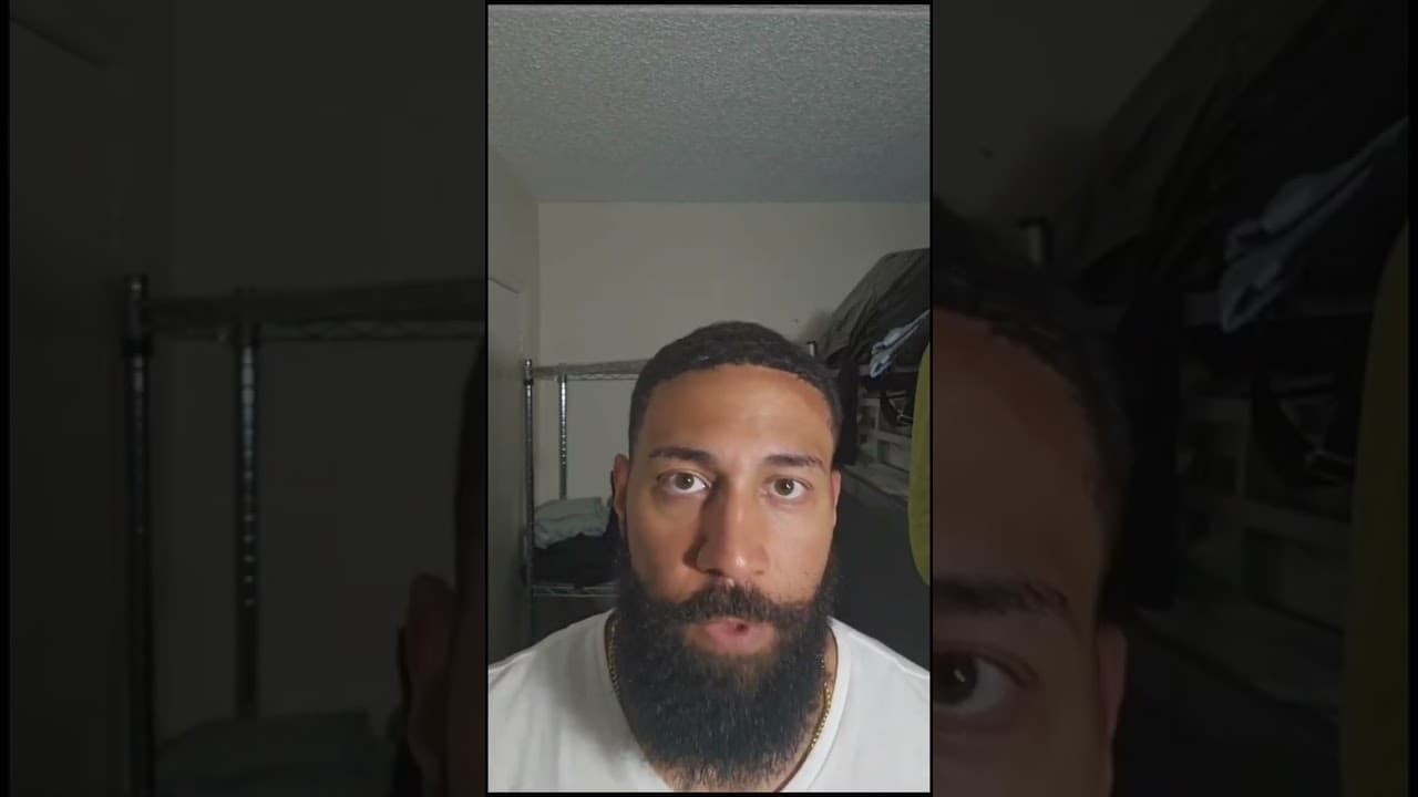 Afro Hair Transplantation