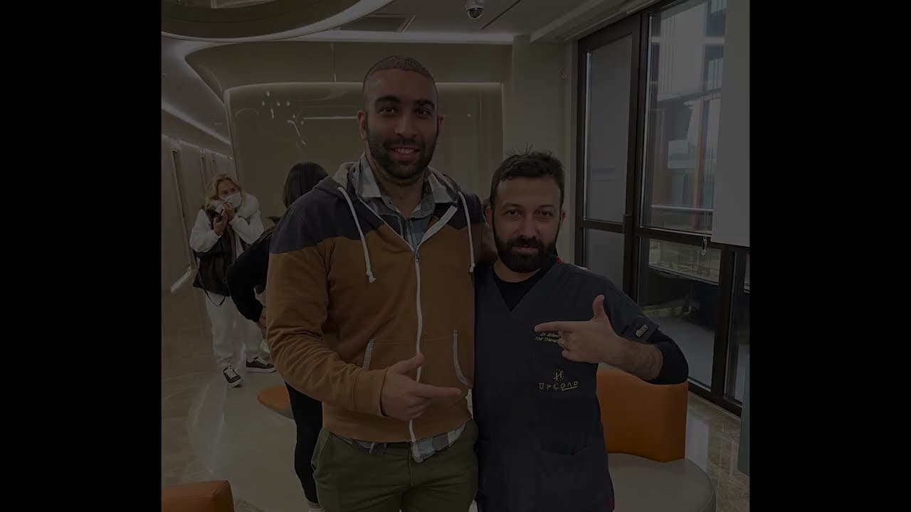 Hair Transplant Story - Yusuf S. Z. | 5300 GRAFT | UK-LONDON