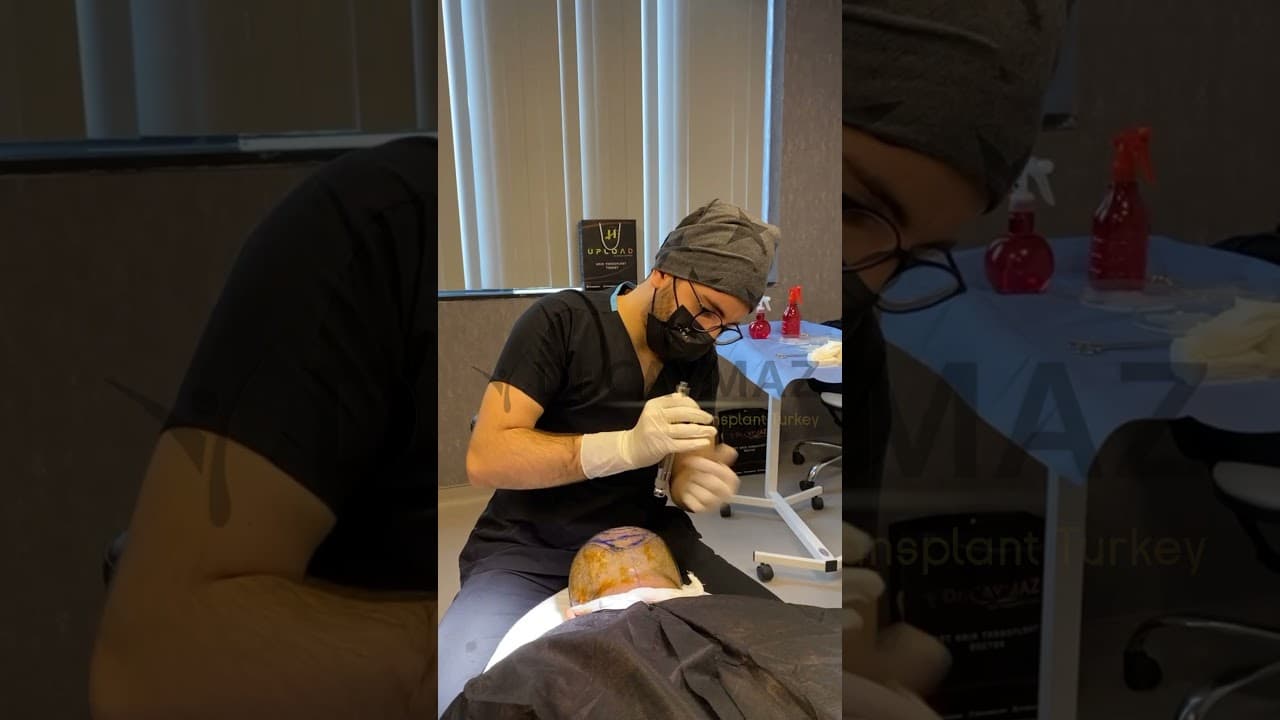 Hair Transplantation in Turkey : 1-2 Operation a Day! by Dr Erkam Caymaz