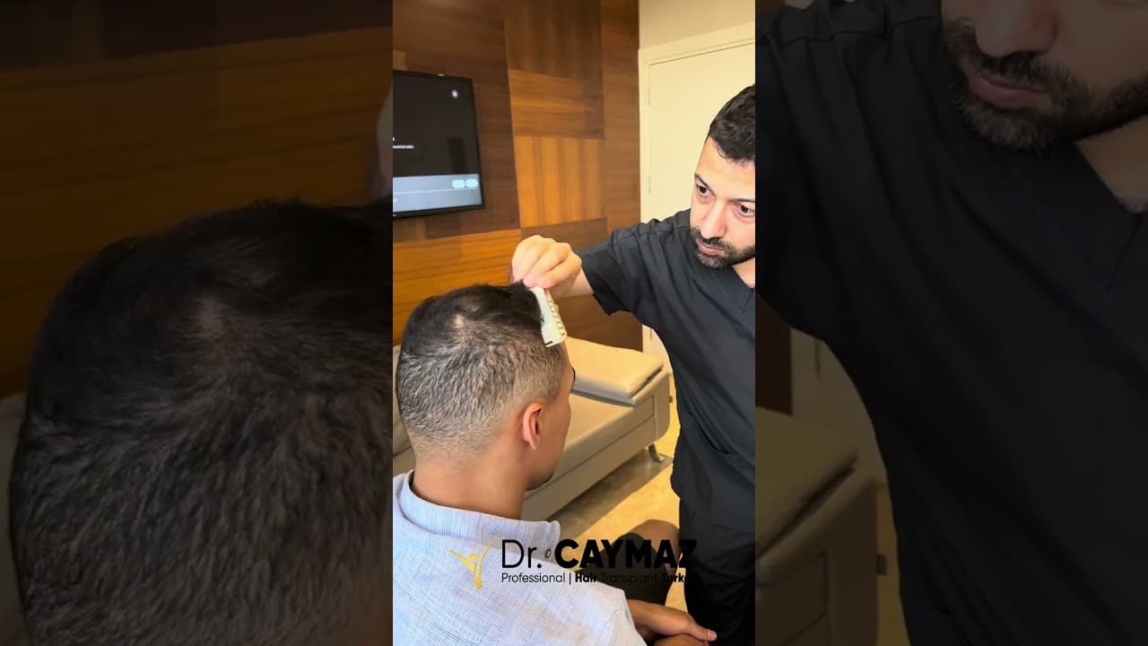 Hairline Creating by Dr.Caymaz