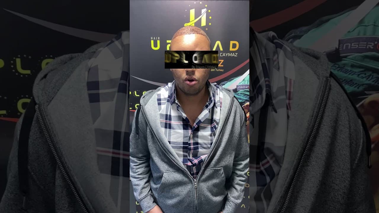 Mr Private from USA - 4000 Graft - Hair Upload - Hair Transplant in Istanbul