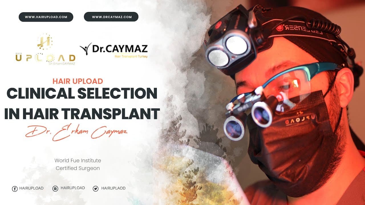 Clinical Selection in Hair Transplant