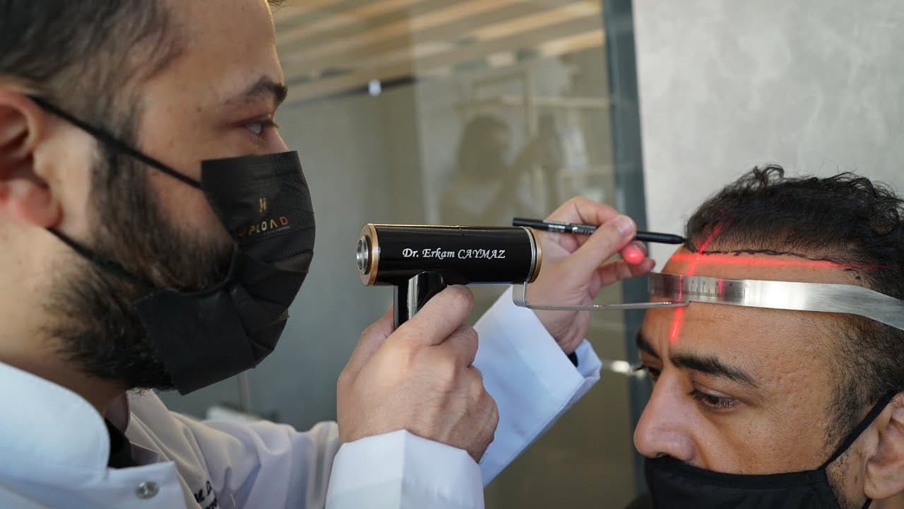 1 Day 1 Vip Operation a Day by Dr Caymaz | Hair Upload Clinic