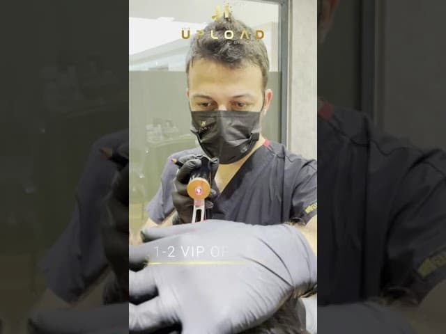 Unshaven Hair Transplant Operation