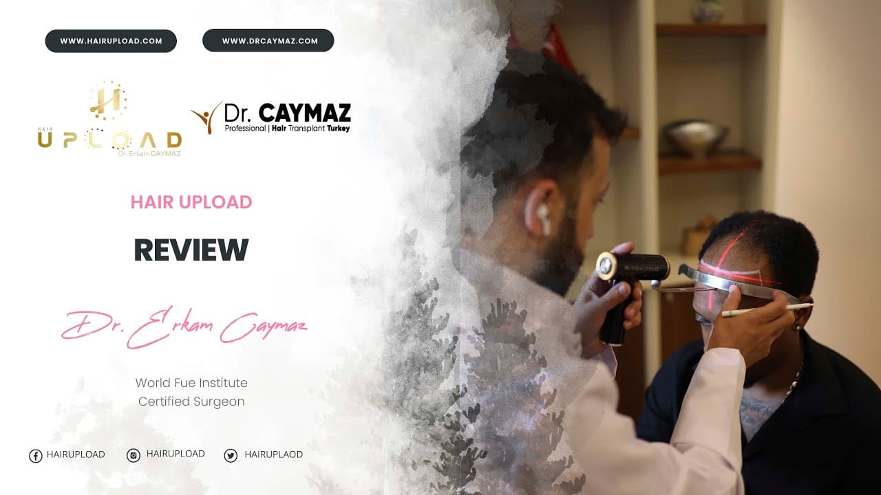 Justin Quinton John 3900 Graft | Hair Transplant Review | USA