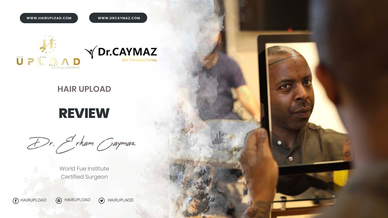 Christopher Sieh - 3200 Graft | Hair Transplant Review | Australia