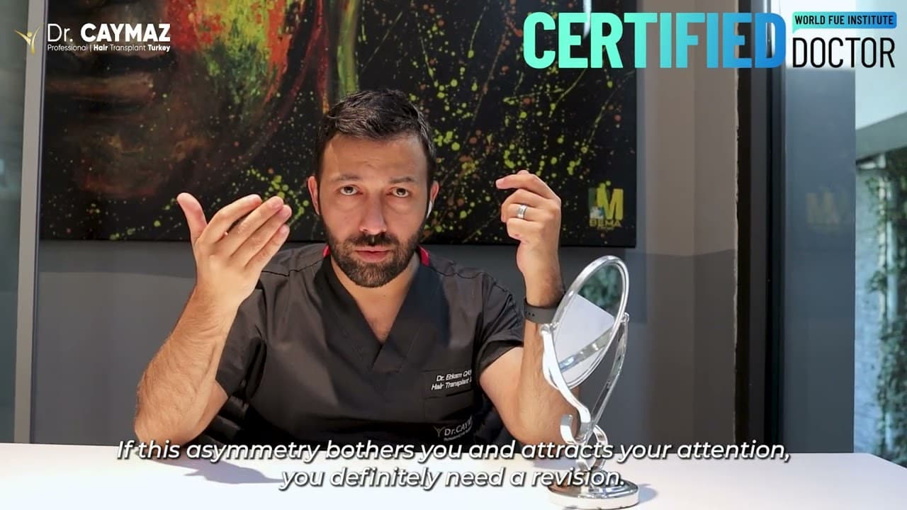 Asymmetry in Hair Transplantation