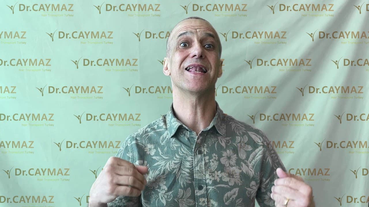 Mr Eduardo - Brasil Reveja - Hair Transplant Istanbul