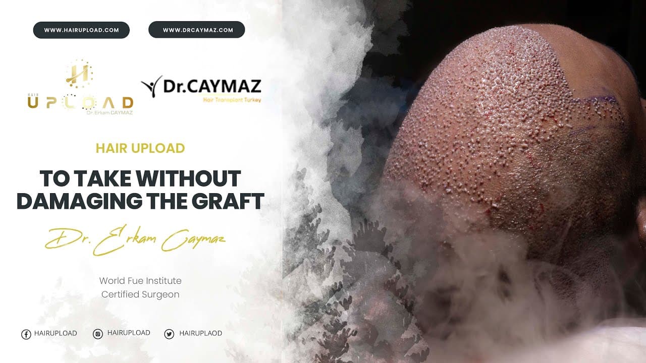 To Take Without Damaging The Graft - Hair Transplant Turkey