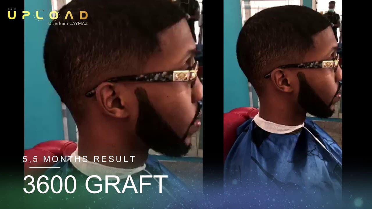 Afroamerican 5,5 Months Result - 3600 Graf