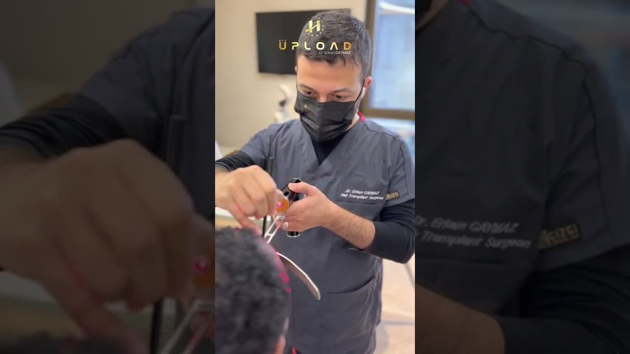 Hairline Designing by Dr. Erkam CAYMAZ