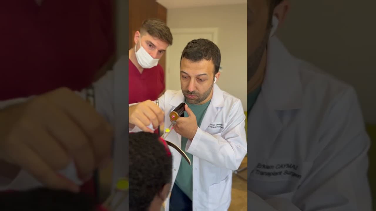 Afro Hair Transplant in Istanbul