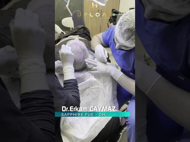 Hair Transplant Process in Istanbul