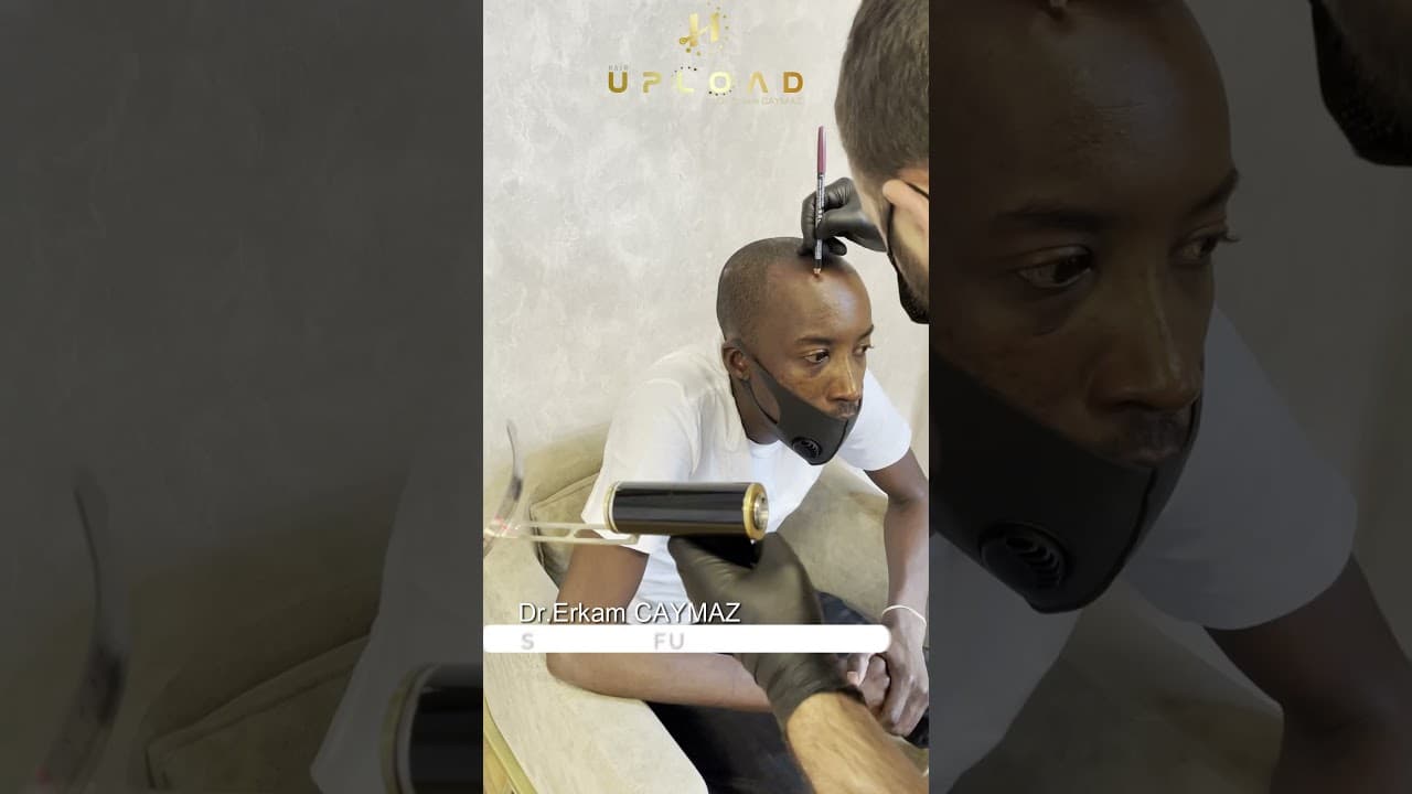 Afroamerican Hairline