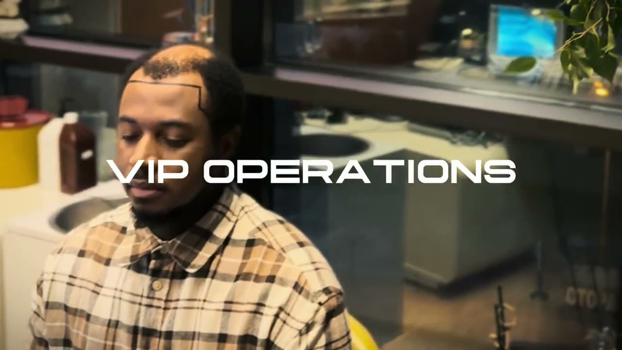 Hair Transplant by Dr Caymaz