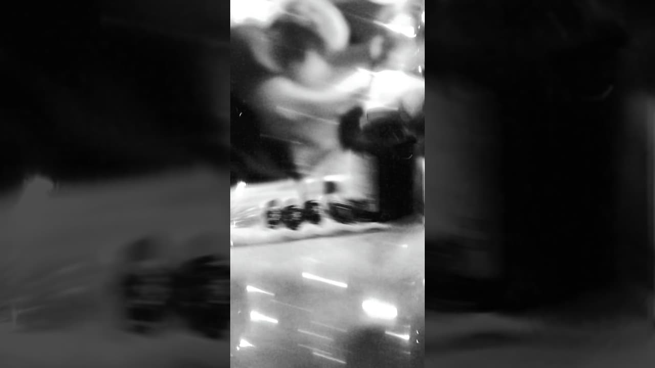 Best Hair Transplant Doctor