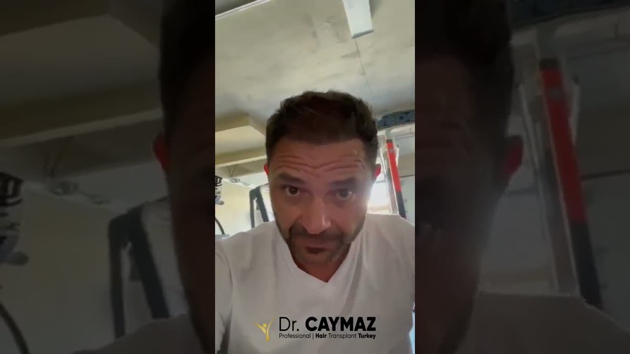 Mr.Elvir / USA / 7 Months / Hair Transplantation Result Review in Turkey
