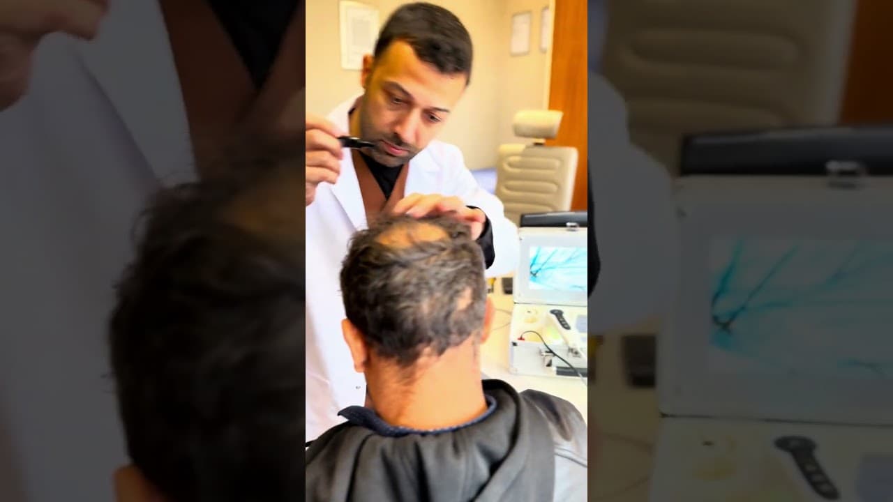Best Hair Transplantation in Turkey