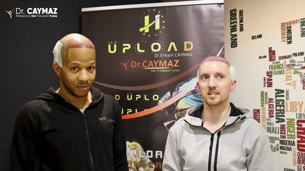 Wilbert Lee & Kurt Daniel LEE - USA-Afro American Hair Transplant Review - Sapphire Blade Incision