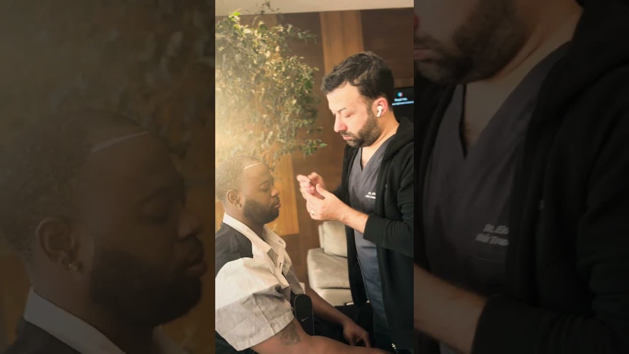 Natural Hairline Designing