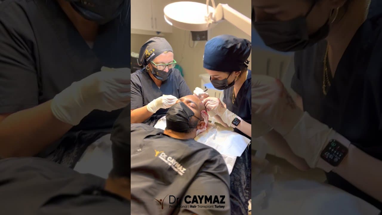Dr Erkam CAYMAZ Hair Transplantation in Istanbul