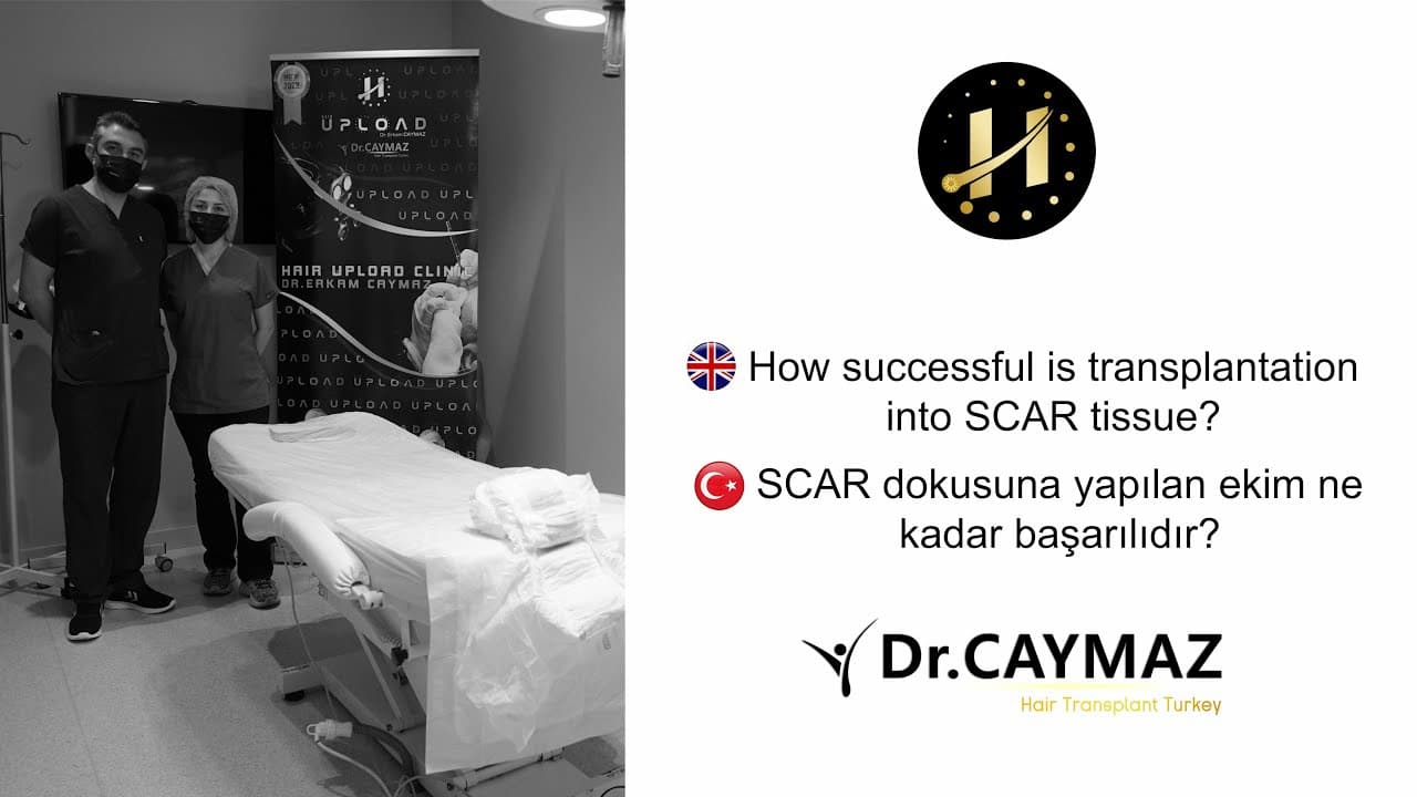 How to succesfull is transplantation into Scar tissue