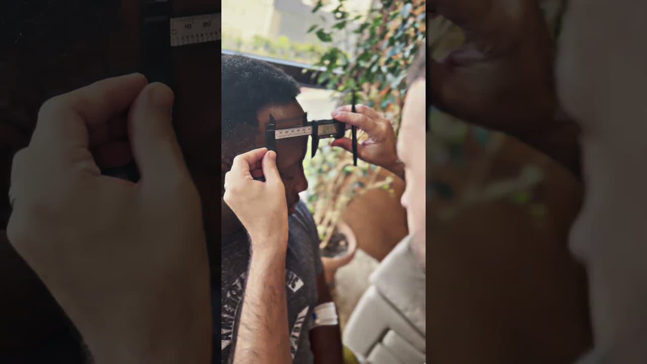 Best Afro Hair Transplant Doctor #afrohairtransplant