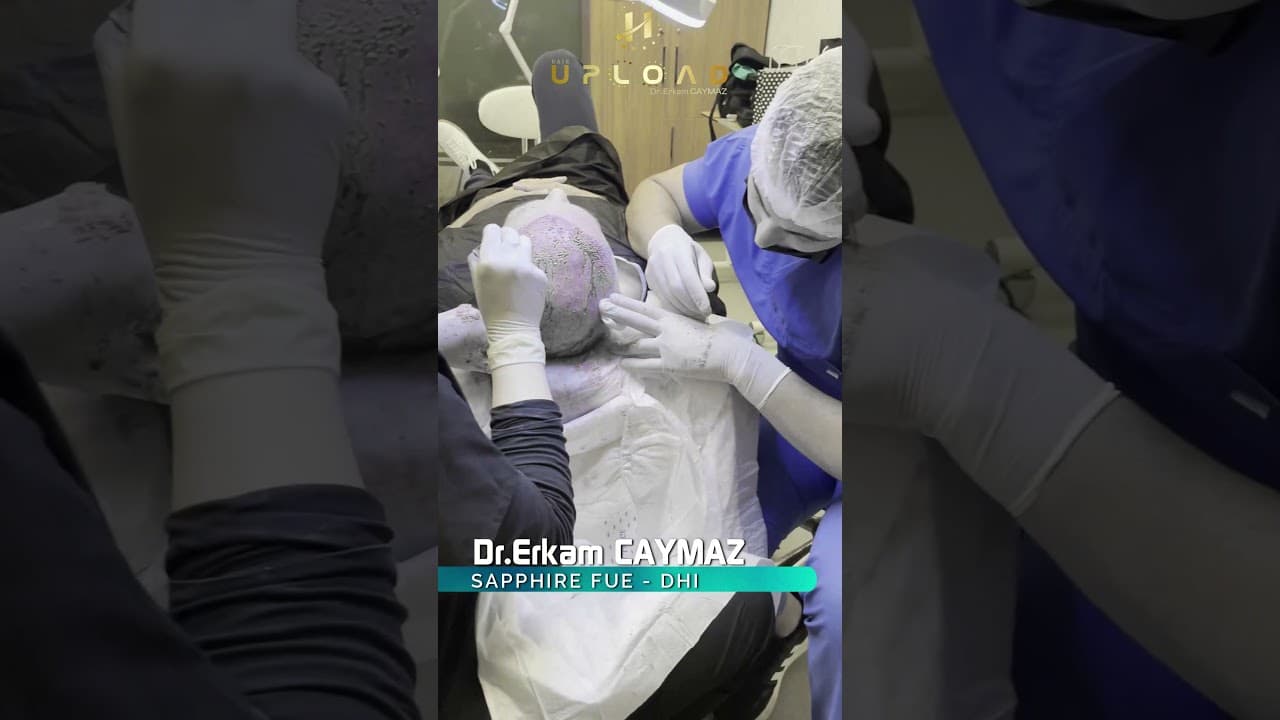 Hair Transplant Process by Hair Upload Clinic