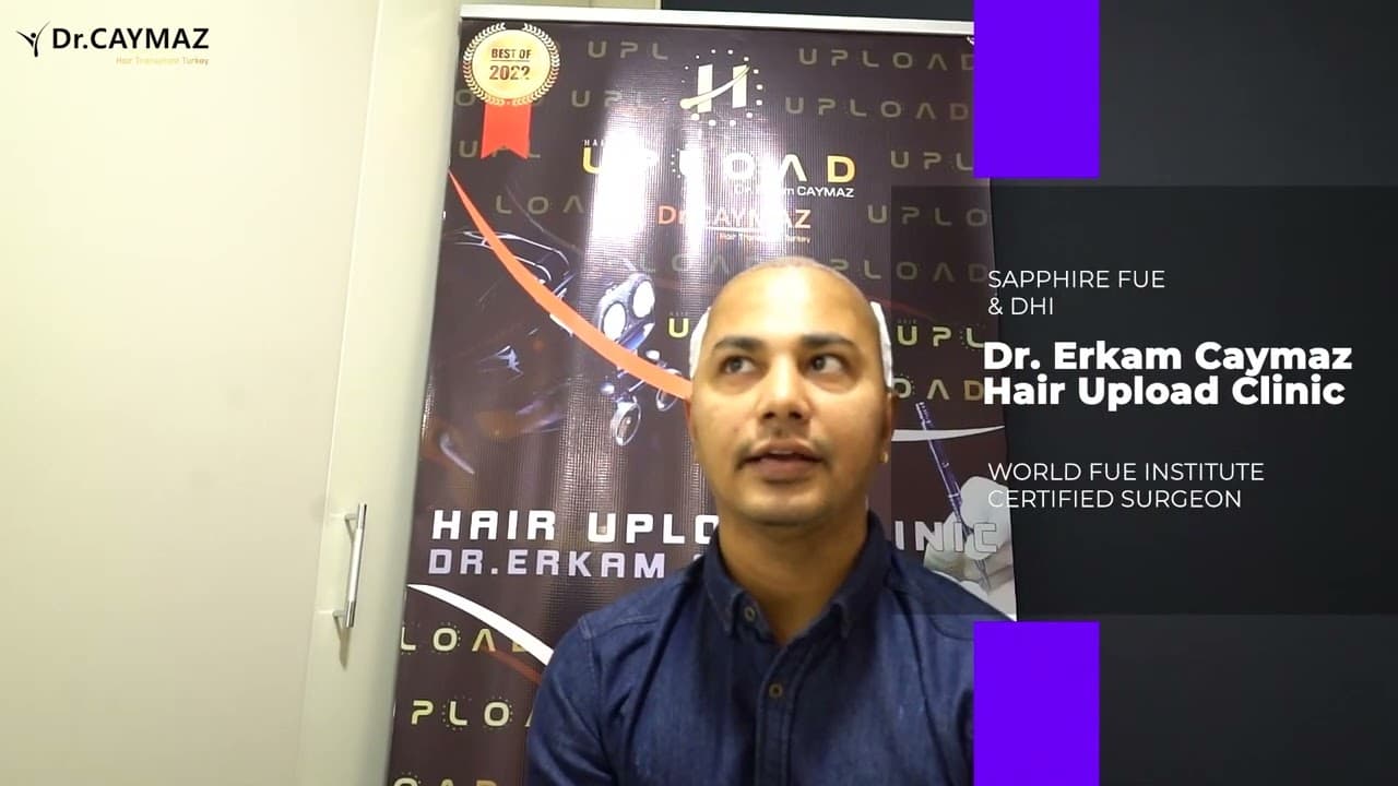 Hair Transplant Review from MR Shatir 4