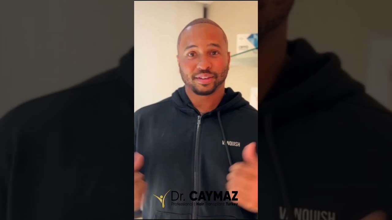 Mr.Henderson | Hair Transplant Review | USA