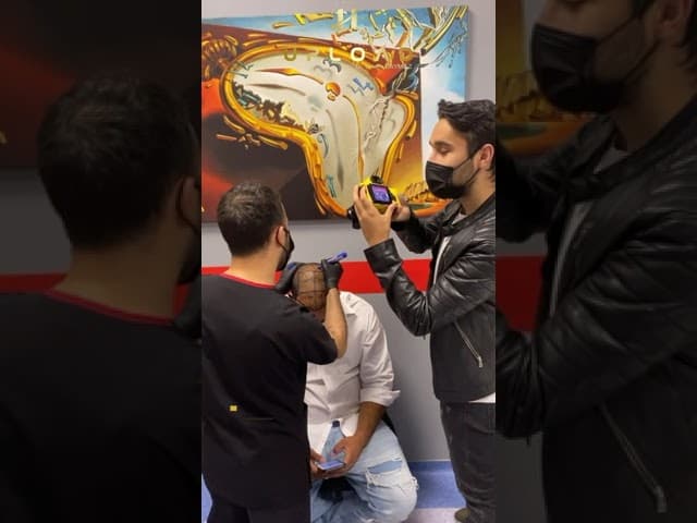 Hair Implantation in Istanbul