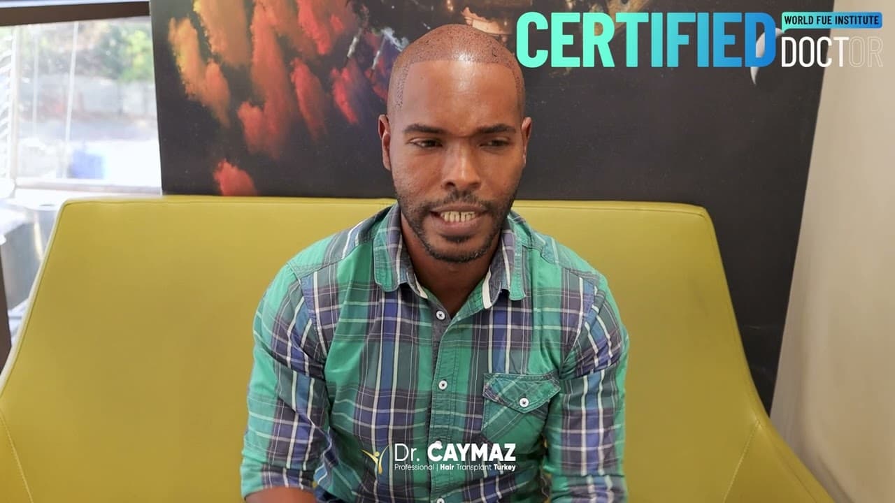 Dannys Jorge Martinez Herrera | Sapphire FUE | 2700 Graft | Spain - Hair Transplant